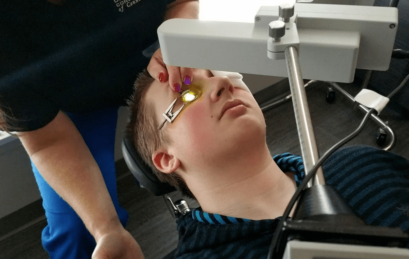Crossing effectively eliminates keratoconus at the beginning of its development